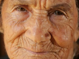 what-causes-wrinkles-1_TOP