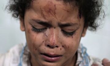 A Palestinian girl cries while receiving treatment for her injuries